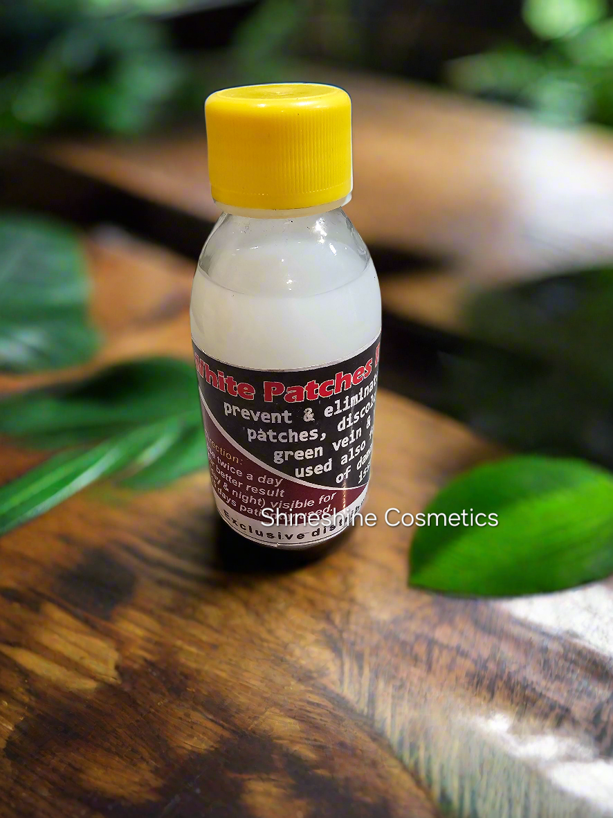 White Patches Treatment Solution
