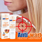 Aichun Beauty Anti Wart Cream